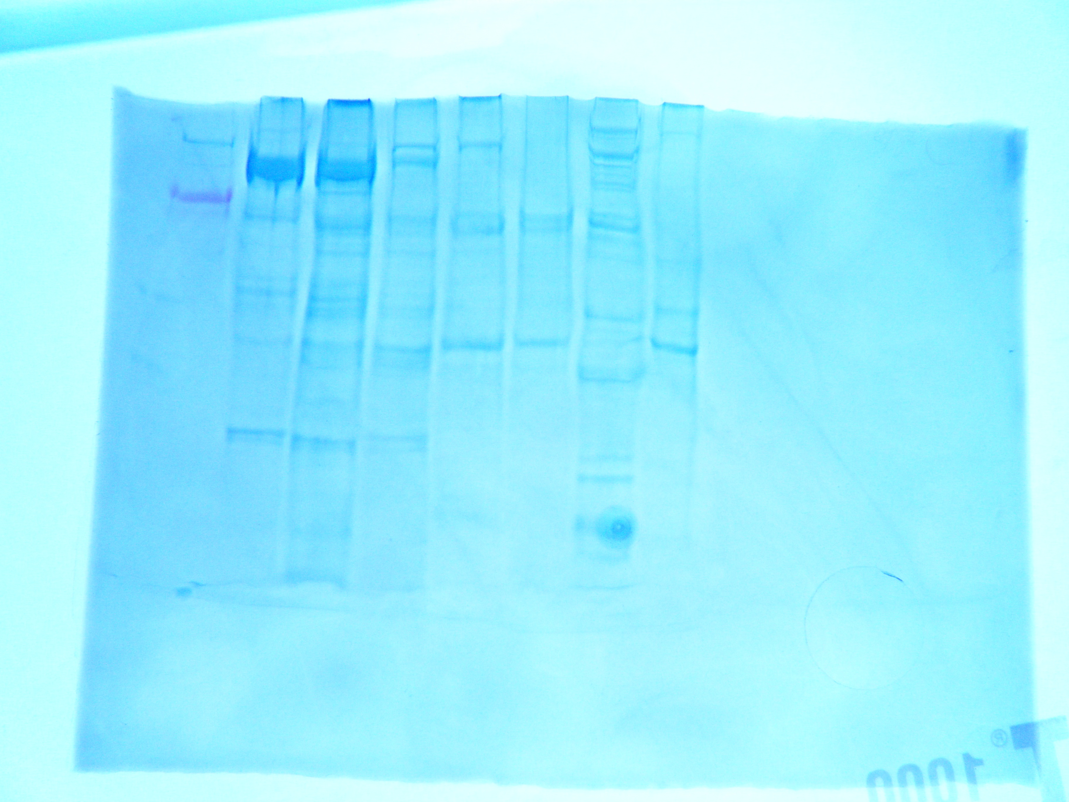 gel_from_western_blot